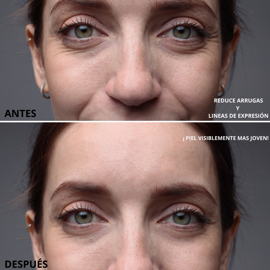 Serum Antiedad - DFShop